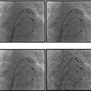 What is the length for each frame. Case 3: example results from the blob detection method of ...