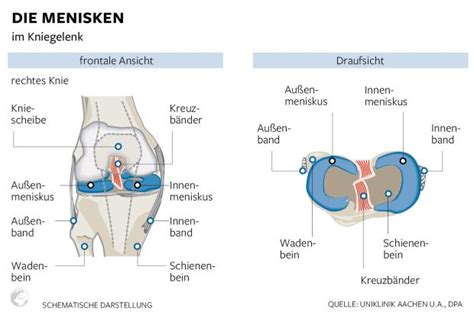 Das kniegelenk ist das größte gelenk des menschlichen körpers. Knie: Kaputten Meniskus unbedingt behandeln lassen - DIE WELT