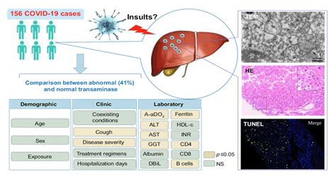 Sars Cov 2 Infection Of The Liver Directly Contributes To Hepatic
