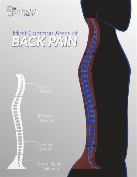 As such, each dermatome transmits sensory details from a particular area of skin back to your brain. Back Pain Causes, Diagnosis, Treatments & Procedures | Plano, TX