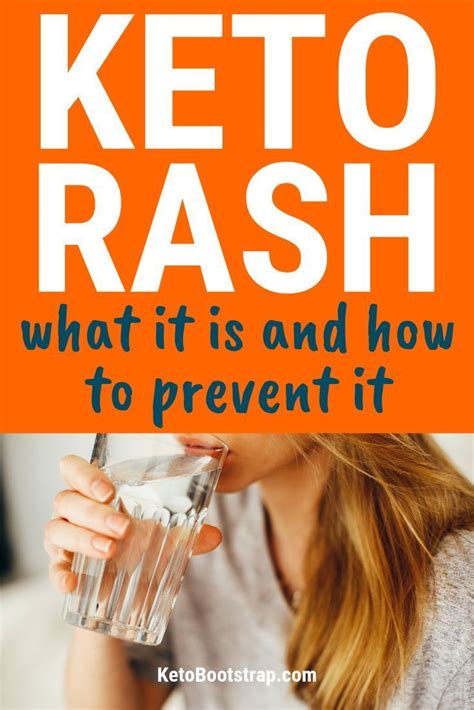 Keto Rash What It Is And How To Prevent It In 2020 Keto Rash Keto Diet