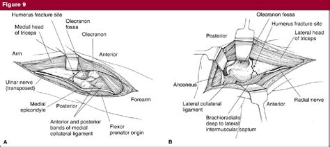 Figure 2 From Surgical Exposures Of The Humerus Semantic Scholar