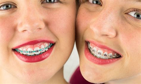 What Happens During An Adjustment Appointment Myorthodontist Vancouver