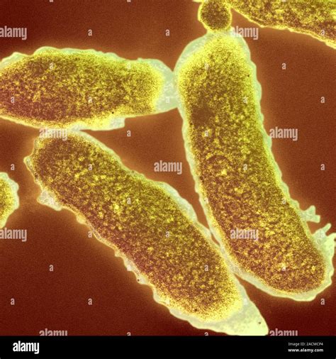 Cholera Bacteria Transmission Electron Micrograph Sem Of Vibrio