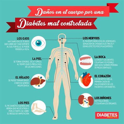 Diabetes mellitus tipo ii • recomendaciones específicas de la oms para la. CÓMO AFECTA LA DIABETES A LA SALUD BUCODENTAL - Clínica ...