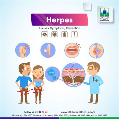 genital herpes diagnosis