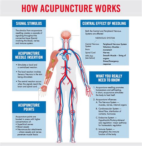 Acupuncture Chinese Medicine How It Works Medicinewalls