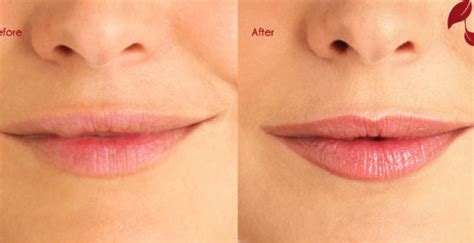 Semi Permanent Makeup Before And After Pictures Saubhaya Makeup