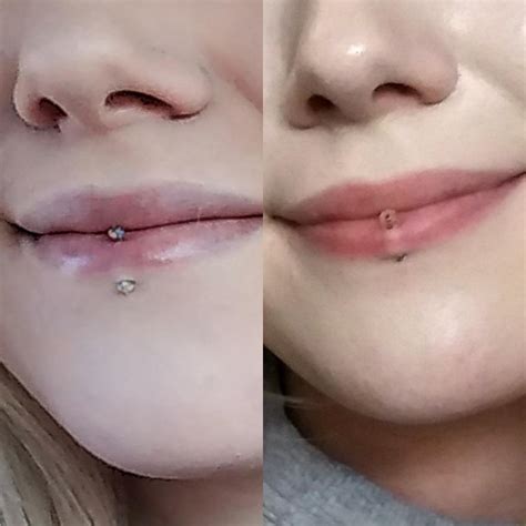 Healing Vertical Labret Ph