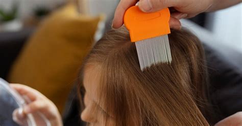 What Are Different Head Lice Screening Options Lca Greenville And Anderson