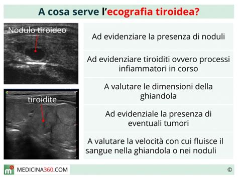 Differenza Tra Ecografia Tiroidea E Ecocolordoppler Tiroideo
