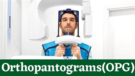 Orthopantomogram Opg X Ray Machine Dental X Rays Purpose And Procedure