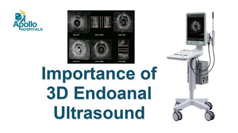 Importance Of 3d Endoanal Ultrasound Colorectal Surgery Apollo Hospitals Hyderabad Youtube
