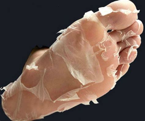 Deep Exfoliation Foot Peel Give Your Crusty Feet A New Lease On Life By