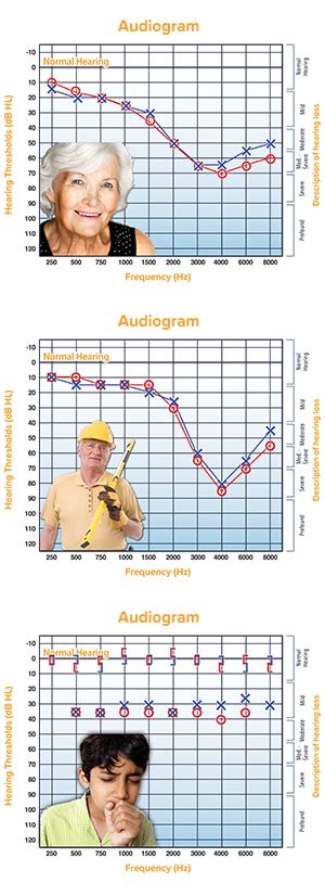 How To Read An Audiogram Complete Hearing Care