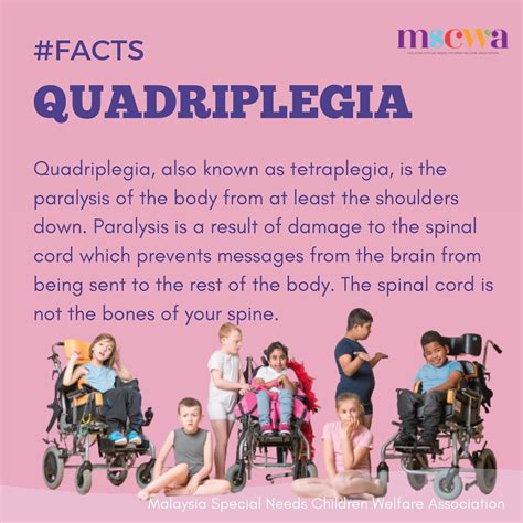 Quadriplegia Quadriplegia Also Known As Tetraplegia Is A Form Of