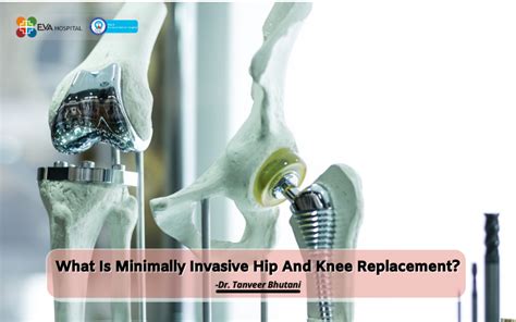 Minimally Invasive Hip And Knee Replacement Eva Hospital