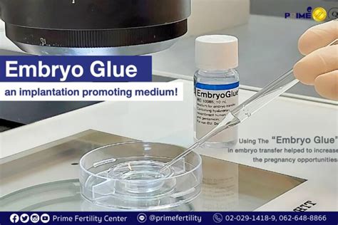 What Is Embryo Glue Detailed Information