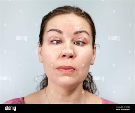 Mujer Con Ojos Golpeados En La Nariz Ojos Cruzados Locura Retrato Sobre Fondo Gris Serie De