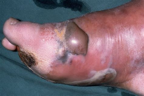 We did not find results for: Most Common Species of Clostridium | Medical Laboratories