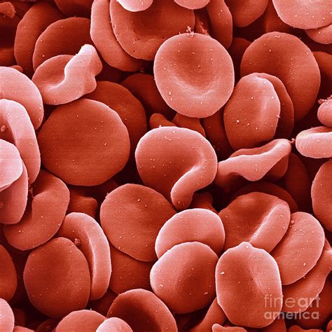 Red Blood Cells Photograph By Juergen Bergerscience Photo Library