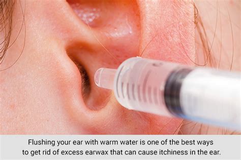 How To Get Rid Of Itchy Ears 9 Tips And Home Remedies