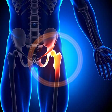 What Are The Most Common Causes Of Groin And Leg Pain