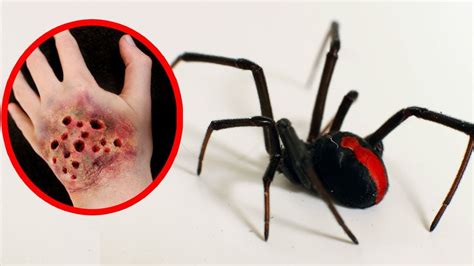 Are Large Black Spiders Poisonous Trust The Answer