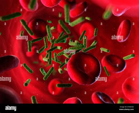Bacterial Infections Fotografías E Imágenes De Alta Resolución Alamy