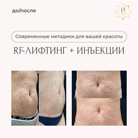 Диет после родов