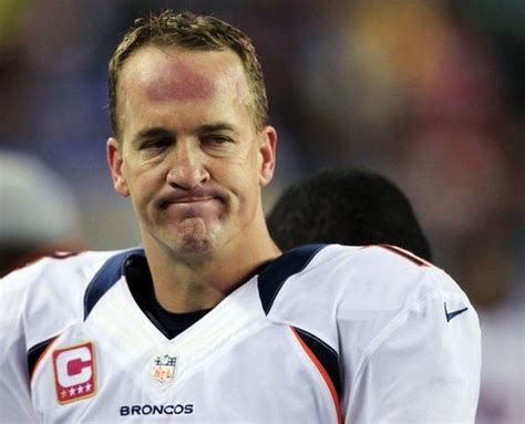 I mean, just look at him out on the football there's something very strange going on with his forehead. What Is Wrong With Peyton Manning's Forehead? - Barnorama