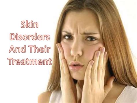Skin Disorders And Their Treatment Ppt