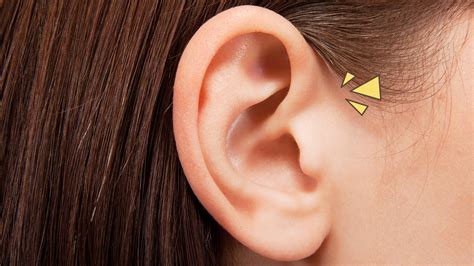 Telinga Kiri Berdenging Menurut Medis Homecare