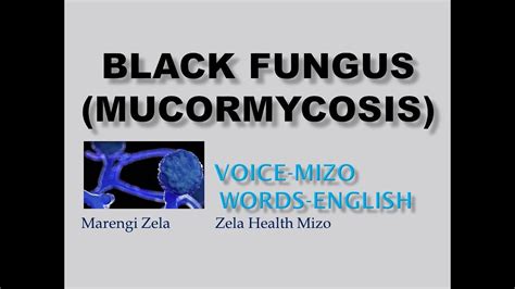 Black Fungusmucormycosis Mizo Youtube