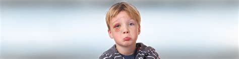 Facial Cuts And Bruises Urgent Care By Urgent Specialists