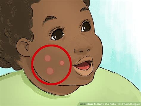Random skin rashes are not due to food allergy. How to Know if a Baby Has Food Allergies (with Pictures ...