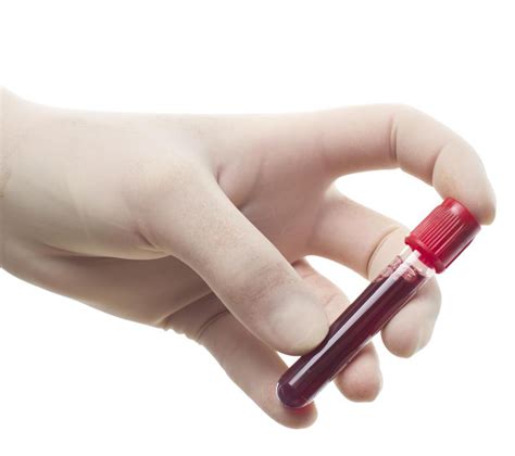How much does blood pregnancy test cost? Where To Get A Pregnancy Blood Test Near Me - Pregnancy ...