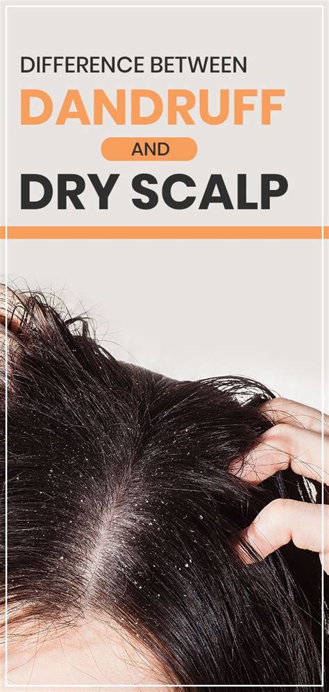 Learn About The Difference Between Dandruff And Dry Scalp And The