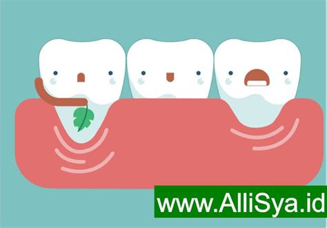 Terdiri atas jaringan mukosa yang menutupi tulang alveolar di dalam rongga. Obat Alami Gusi Bengkak Paling Mujarab - Allianz Syariah