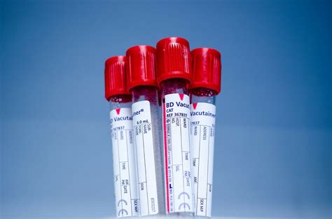 ¿qué its se pueden detectar con un examen de sangre