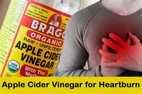 The All Natural Heartburn Relief Recipe Natural Remedies For