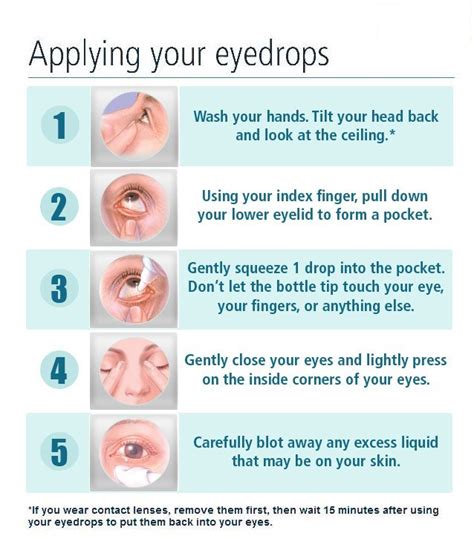 How To Put In Eye Drops — Eye Florida