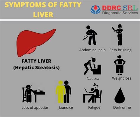 Symptoms Of Fatty Liver Hepatic Steatosis