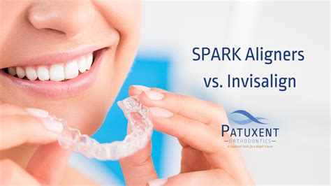 Spark Aligners Vs Invisalign