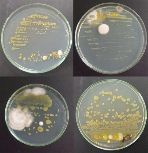 Figura 1 Colônias De Bactérias E Fungos Aos Sete Dias Em Meio Wilbrink