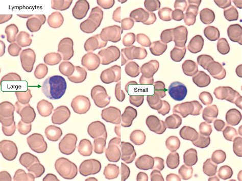 Blood Smears Lab