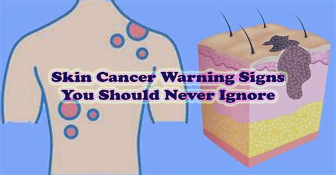 7 Skin Cancer Warning Signs You Should Never Ignore River Oaks Beauty Bar