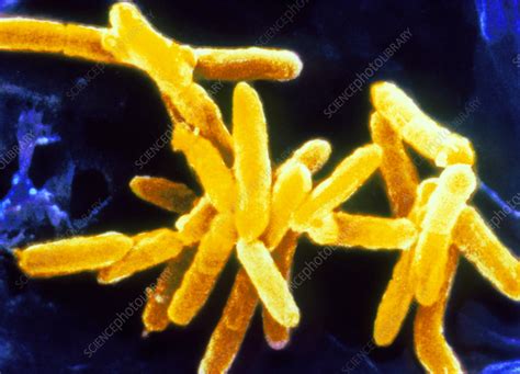 Cardiobacterium Hominis Bacteria Stock Image B2200534 Science