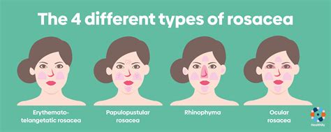 Types Of Rosacea