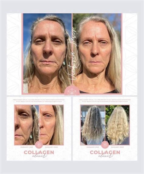 Isagenix Collagen Elixir Review Before And After Photos 2023a Less